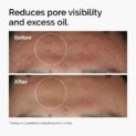 Niacinamide 10% Zinc 1% Results