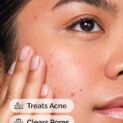 Salicylic Acid 2% Solution Actions