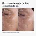 Glycolic Acid 7% Exfoliating Toner Results