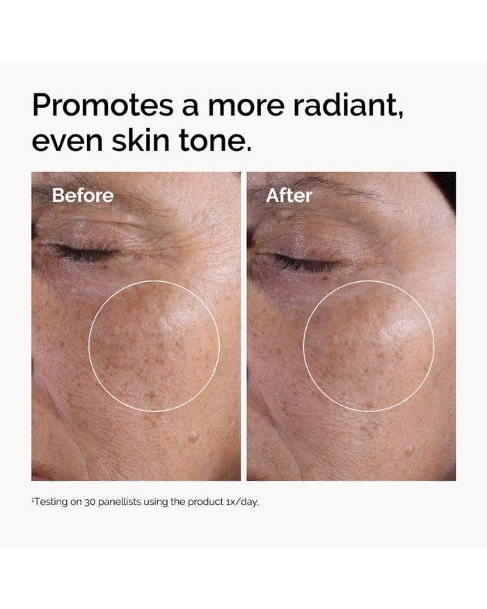 Glycolic Acid 7% Exfoliating Toner Results Glycolic Acid 7% Exfoliating Toner Results